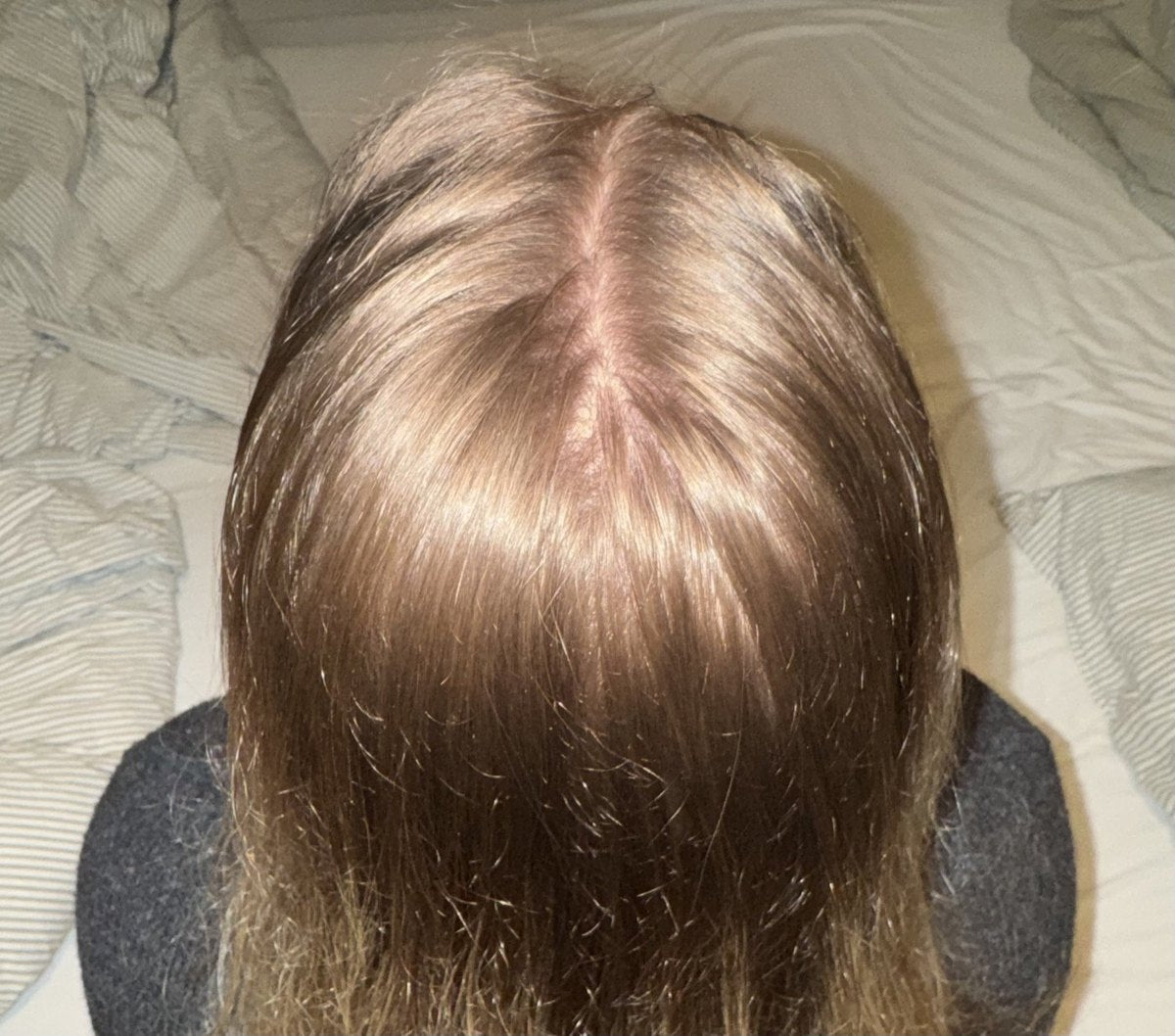 Hårserum Malene — efter 3 måneder