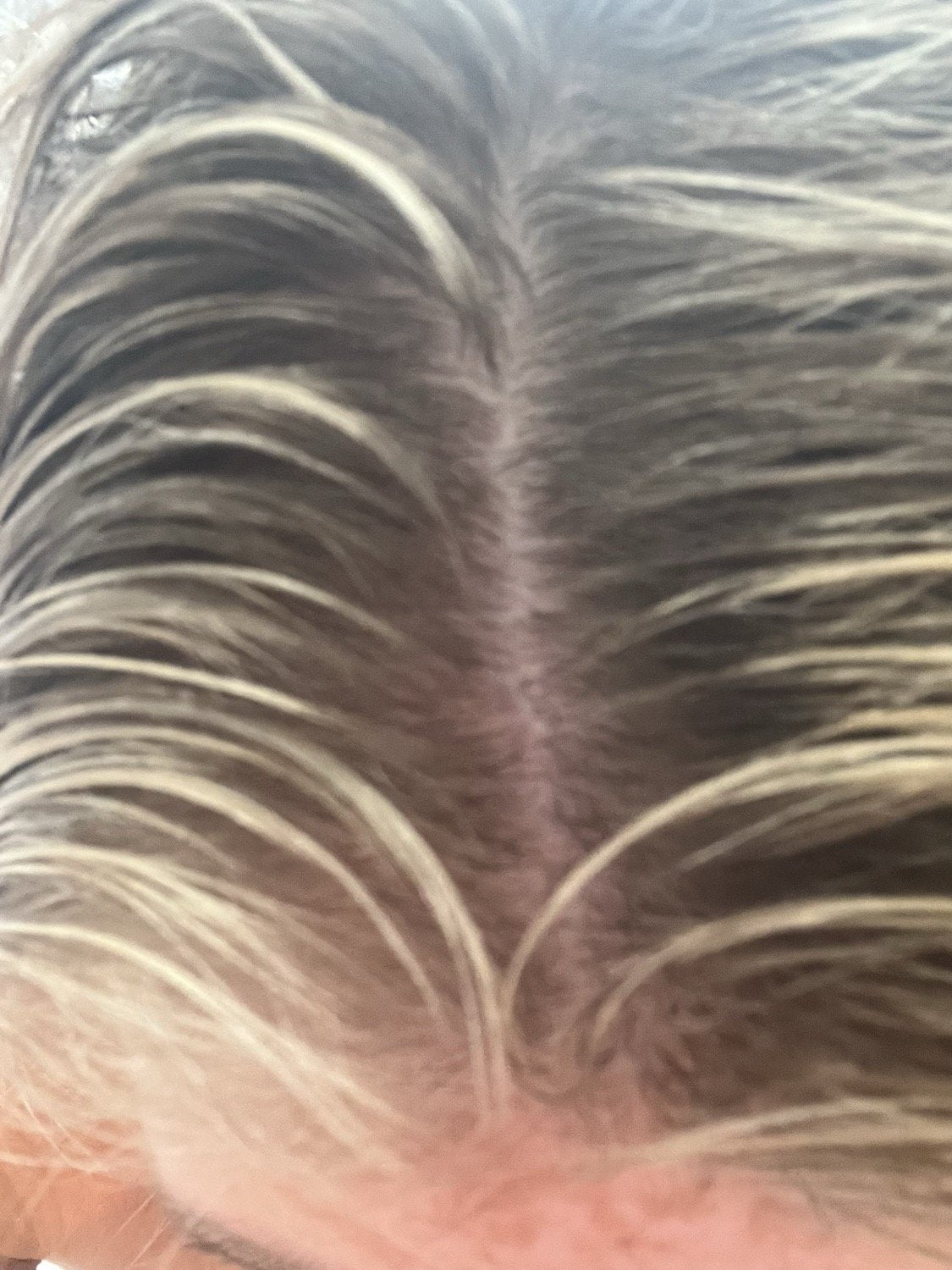 Hårserum case 2 — efter
