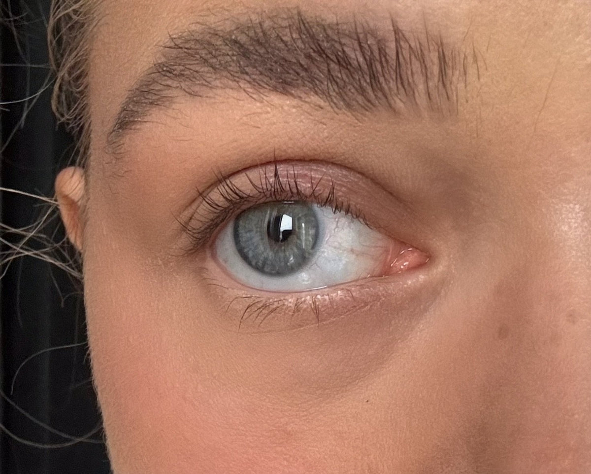 Vippeserum Emma — efter