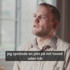 Steffen fortæller om en plet uden hår i nakken og resultatet med Naturligolie Hårserum