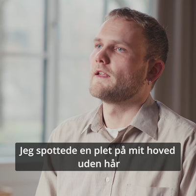 Steffen fortæller om en plet uden hår i nakken og resultatet med Naturligolie Hårserum