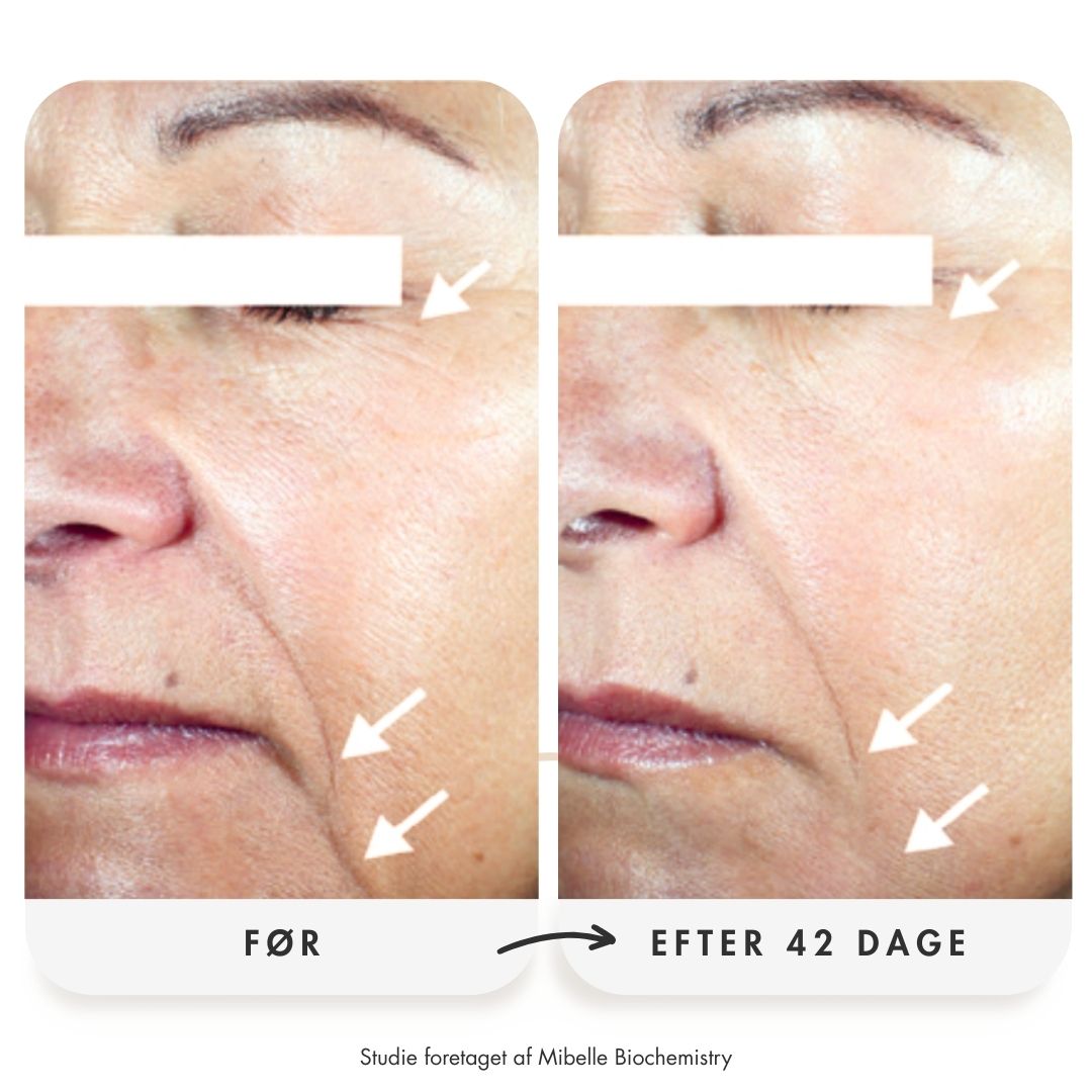 Pro Age serum før efter 42 dage